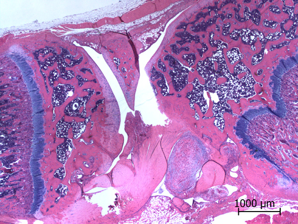 Case #11, Fig. 1