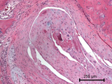 Case 11, Fig. 4