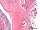 Case 11, Fig. 5