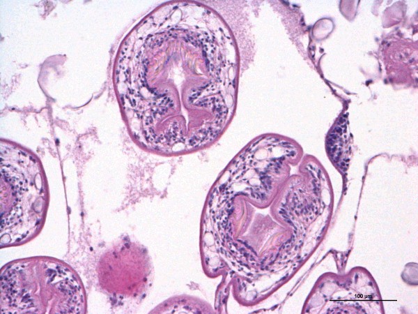 Case #12, Fig. 1