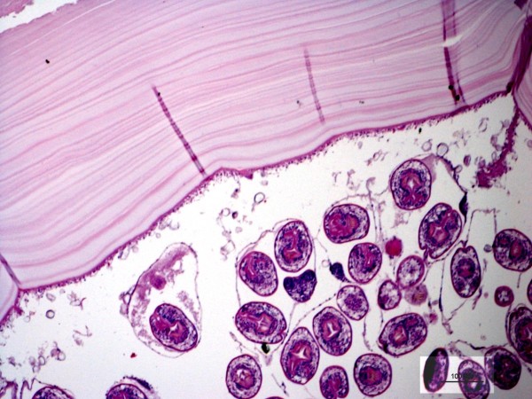 Case #12, Fig. 3