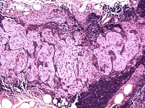 Case #13, Fig. 2