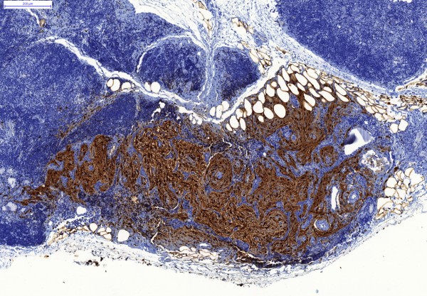 Case #13, Fig. 4