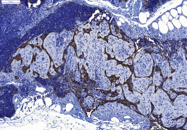 Case #13, Fig. 7