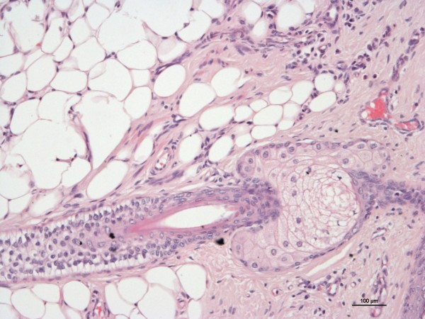 Case #14, Fig. 3