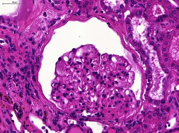 Case #15, Fig. 3