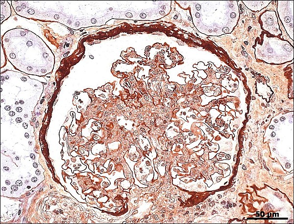 Case #15, Fig. 4