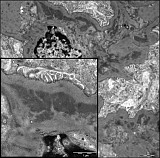 Case 15, Fig. 7