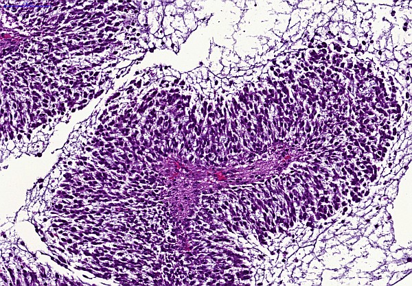 Case #16, Fig. 3