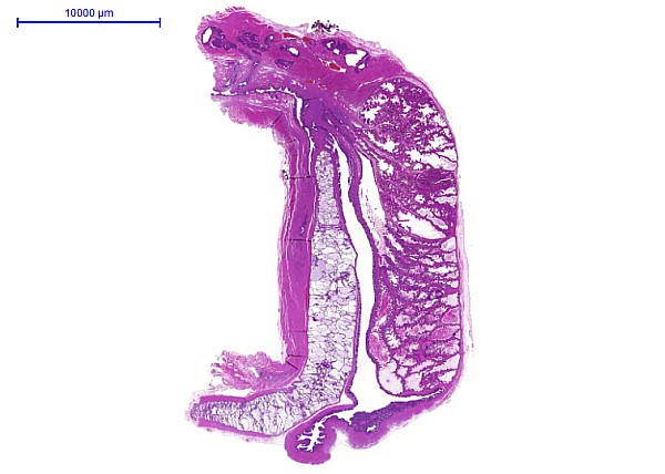 Case #17, Fig. 1