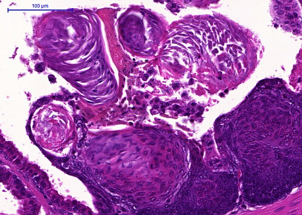 Case #17, Fig. 5