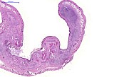 Case 19, Fig. 1