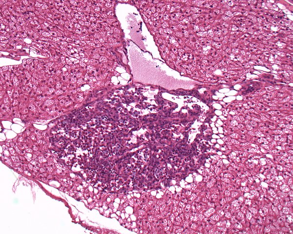 Case #1, Fig. 2