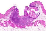 Case 20, Fig. 1