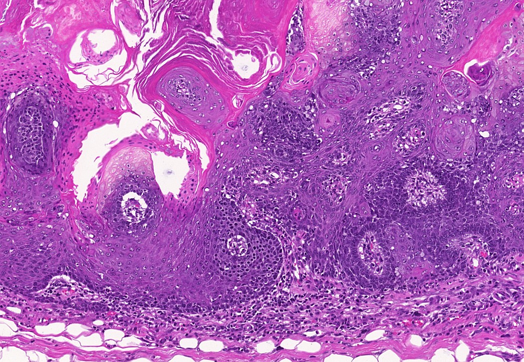 Case #20, Fig. 5