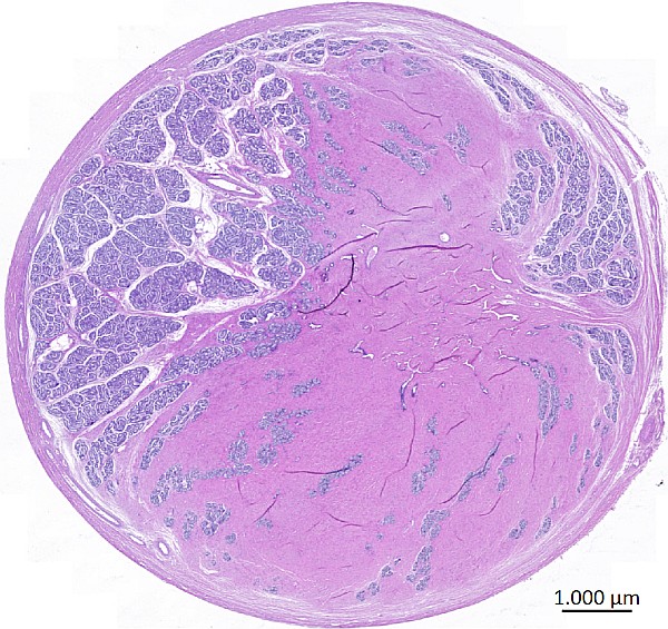 Case #21, Fig. 1