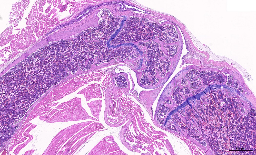 Case #23, Fig. 1