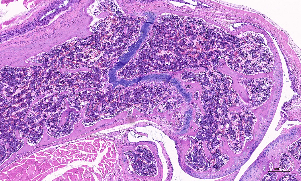 Case #23, Fig. 2