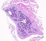 Case 20, Fig. 1