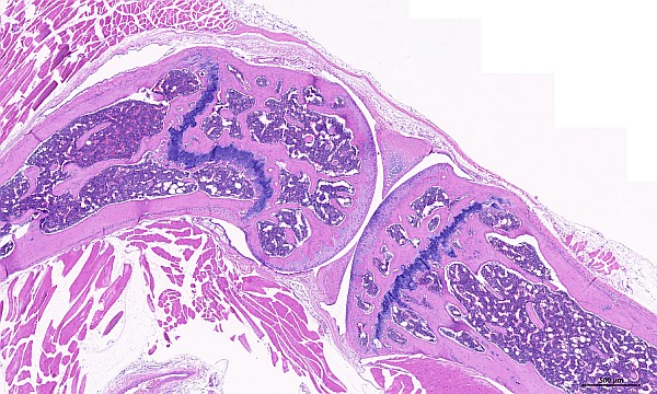 Case #23, Fig. 4