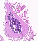 Case 20, Fig. 1