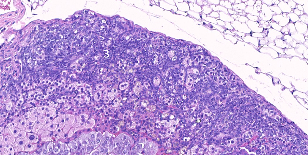 Case #25, Fig. 7