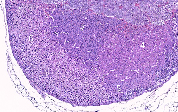 Case #25, Fig. 13