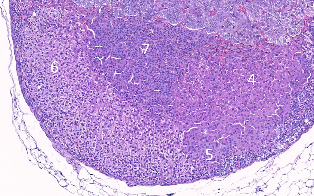 Case #25, Fig. 15