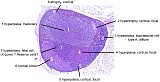 Case 20, Fig. 1