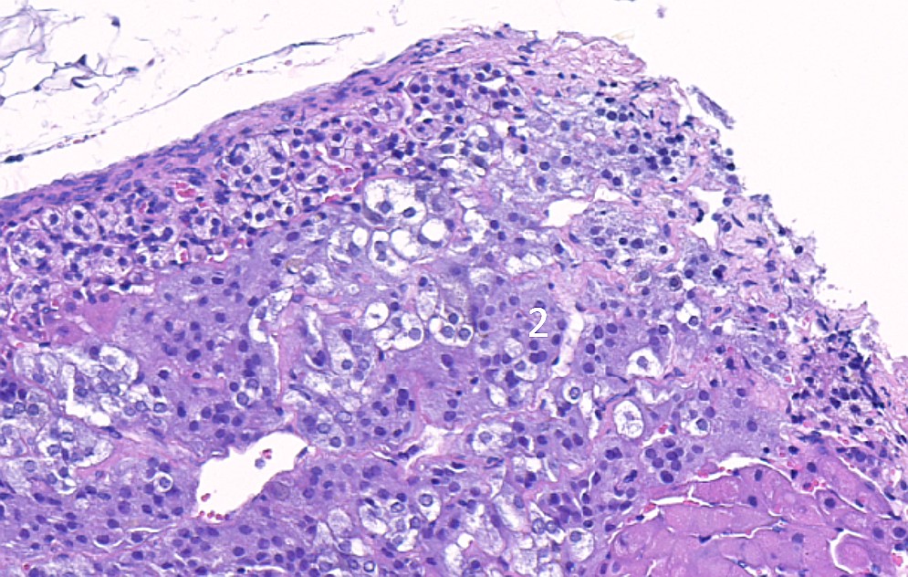 Case #25, Fig. 6