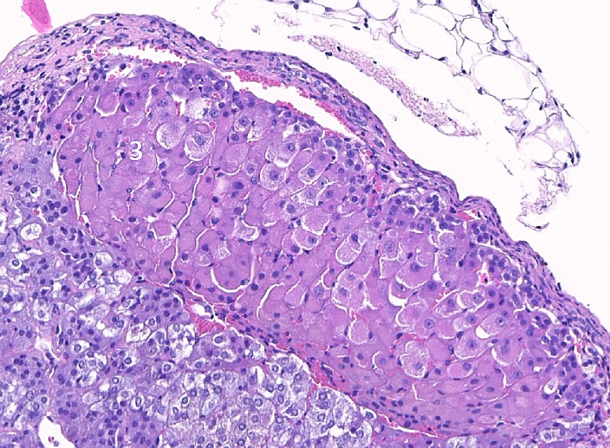 Case #25, Fig. 8