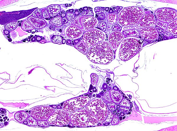 Case #26, Fig. 1