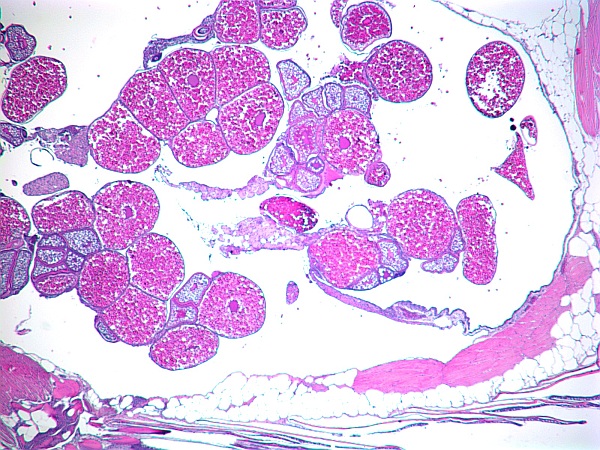 Case #26, Fig. 2