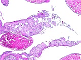 Case 20, Fig. 1