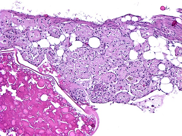 Case #26, Fig. 5