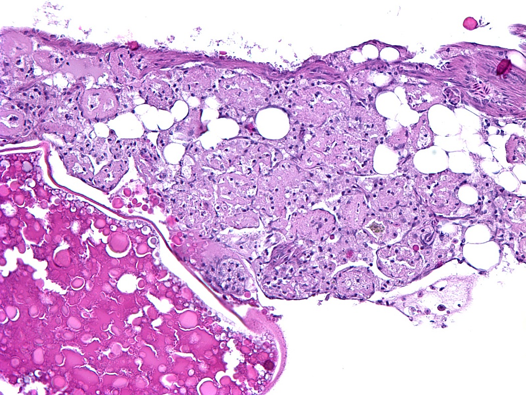 Case #26, Fig. 5