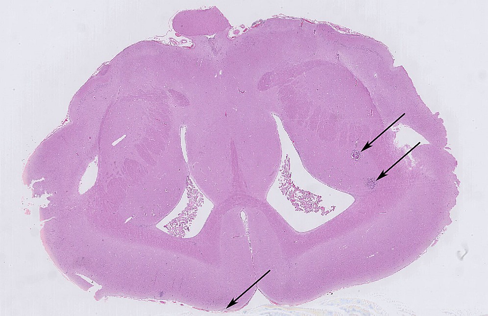 Case #27, Fig. 1