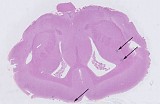 Case 20, Fig. 1