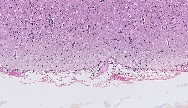 Case #27, Fig. 5