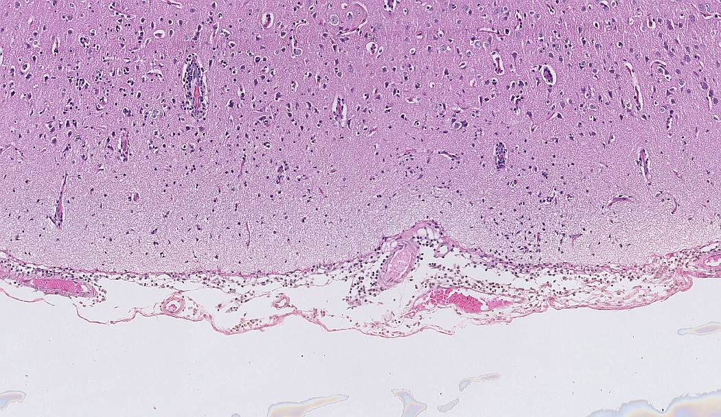 Case #27, Fig. 5