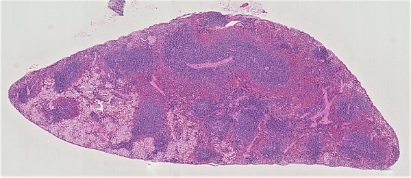 Case #28, Fig. 1