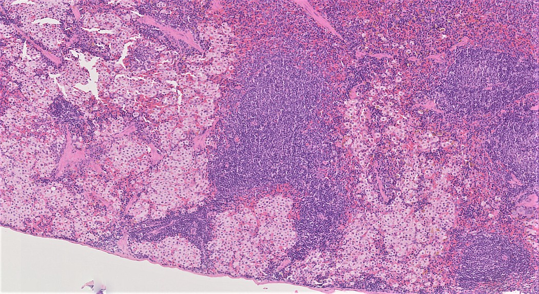 Case #28, Fig. 2