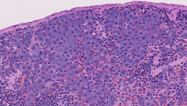 Case #28, Fig. 8