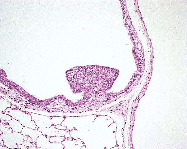 Case #2, Fig. 1