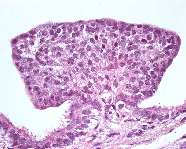 Case #2, Fig. 2