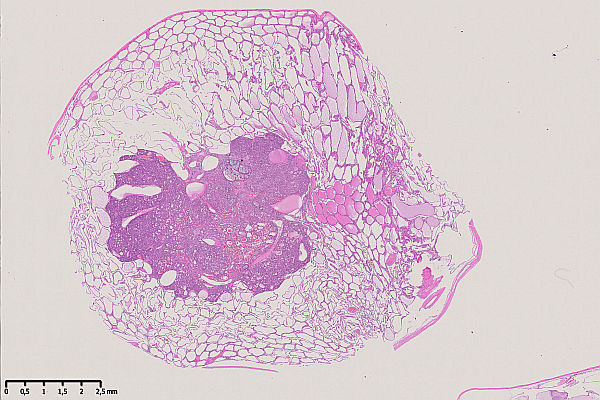 Case #31, Fig. 1