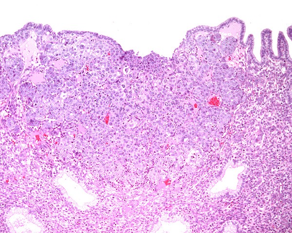 Case #4, Fig. 1