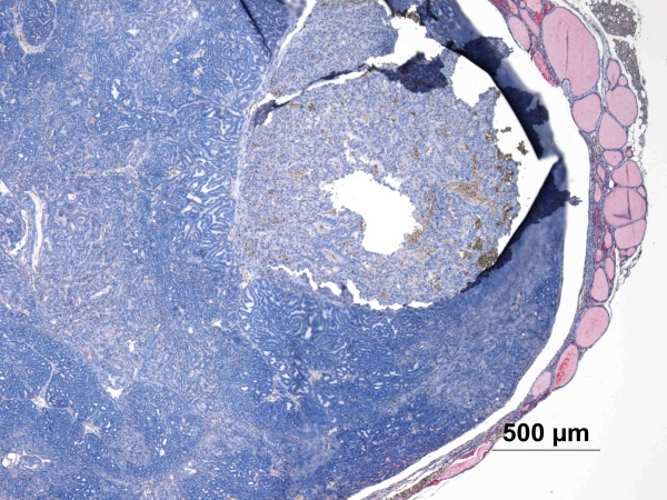 Case #7, Fig. 5