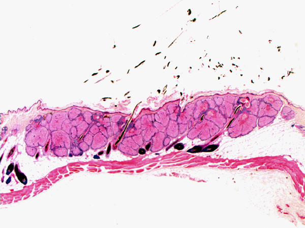 Case #8, Fig. 5