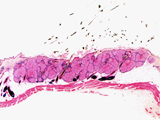 Case 8, Fig. 5